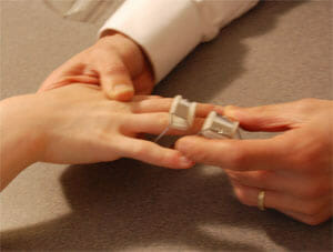 hand therapy