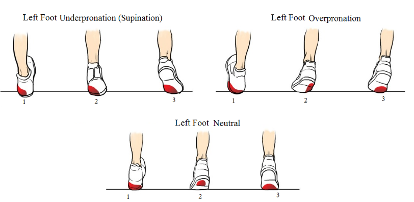 Pronation VS Supination